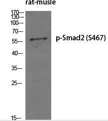 Smad2 (phospho Ser467) Polyclonal Antibody
