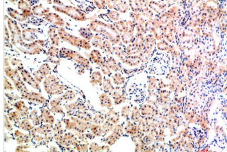 IkB α Rabbit Polyclonal Antibody