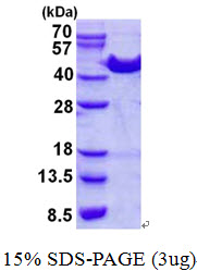 ACAT1, 34-427aa, Human, His tag, E Coli