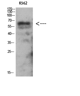 AMPKγ2 Polyclonal Antibody