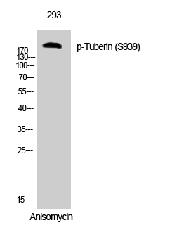 Tuberin (phospho Ser939) Polyclonal Antibody
