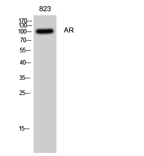 AR Polyclonal Antibody