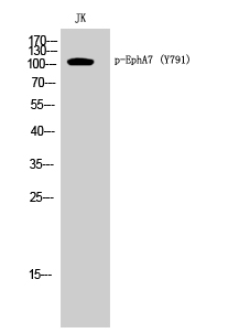 EphA7 (phospho Tyr791) Polyclonal Antibody