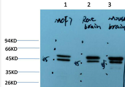 Epsilon Tubulin Mouse Monoclonal Antibody(2B3)