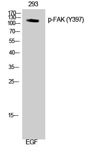 FAK (phospho Tyr397) Polyclonal Antibody