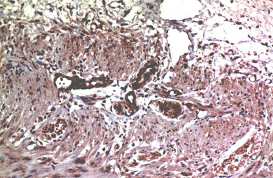 MMP2 Mouse Monoclonal Antibody(1H1)