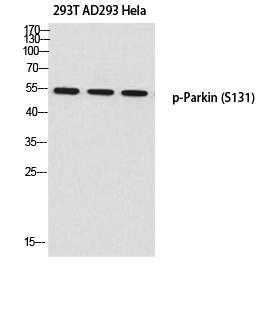 Parkin (phospho Ser131) Polyclonal Antibody