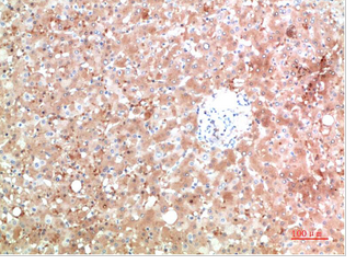 TTR Mouse Monoclonal Antibody(5A11)