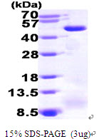 ACADM, 26-421aa, Human, His tag, E Coli