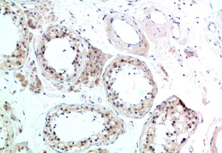 HSC70 Rabbit Polyclonal Antibody