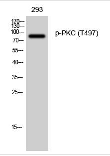 PKC (phospho Thr497) Polyclonal Antibody