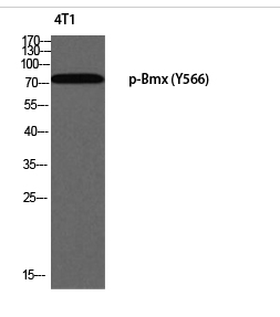 Bmx (phospho Tyr566) Polyclonal Antibody