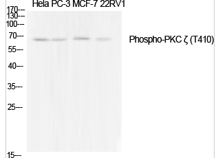 PKC ζ (phospho Thr410) Polyclonal Antibody