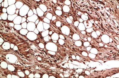 VEGF Rabbit Polyclonal Antibody