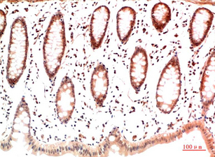 Collagen I Mouse Monoclonal Antibody(4H10)