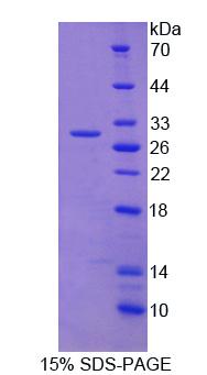 A Disintegrin And Metalloprotease 17 (ADAM17), Recombinant Protein