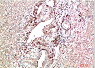 TTR Mouse Monoclonal Antibody(9D9)