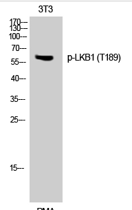 LKB1 (phospho Thr189) Polyclonal Antibody