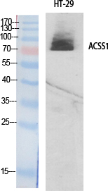ACSS1 Polyclonal Antibody