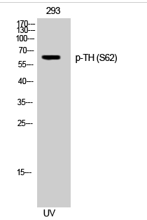 TH (phospho Ser62) Polyclonal Antibody