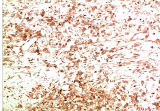 ATG5 Mouse Monoclonal Antibody(8B4)
