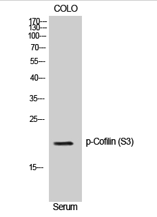 Cofilin (phospho Ser3) Polyclonal Antibody