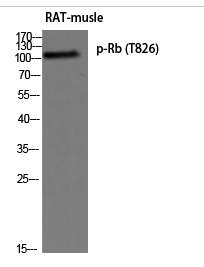 Rb (phospho Thr826) Polyclonal Antibody