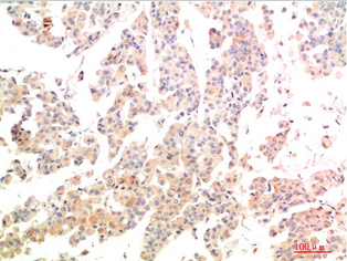 MEK3 Rabbit Polyclonal Antibody