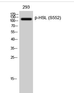 HSL (phospho Ser552) Polyclonal Antibody