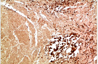 JNK3 Rabbit Polyclonal Antibody