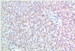 TTR Mouse Monoclonal Antibody(9A6)