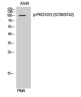 PKD1/2/3 (phospho Ser738/S742) Polyclonal Antibody