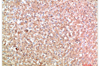 TTR Mouse Monoclonal Antibody(6E5)