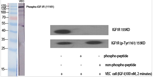 IGF-IR (phospho Tyr1161) Polyclonal Antibody