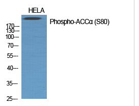 ACCα (phospho Ser80) Polyclonal Antibody