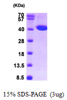 ACADS, 25-412aa, Human, His tag, E Coli