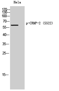 CRMP-2 (phospho Ser522) Polyclonal Antibody