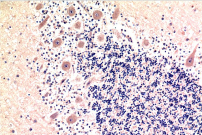LC3B Mouse Monoclonal Antibody(9H5)