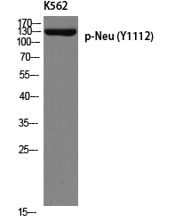 Neu (phospho Tyr1112) Polyclonal Antibody