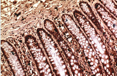Gamma Tubulin Mouse Monoclonal Antibody(7B1)