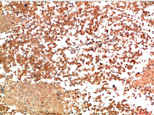HSP90α Rabbit Polyclonal Antibody