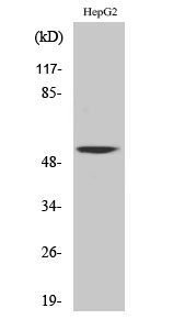 CaMKV Polyclonal Antibody