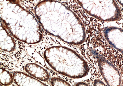 ATM Mouse Monoclonal Antibody(3D3)