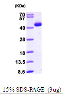 ACAT2, 1-397aa, Human, His tag, E Coli