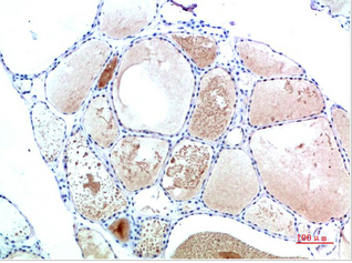 TTR Mouse Monoclonal Antibody(2B12)