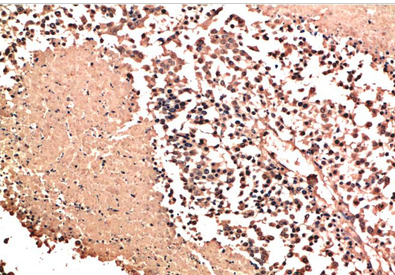NM23A Rabbit Polyclonal Antibody