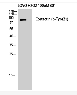 Cortactin (phospho Tyr421) Polyclonal Antibody