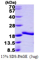 A2LD1, 1-153aa, Human, His tag, E Coli