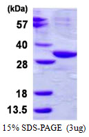 ABHD10, 53-306aa, Human, His tag, E Coli