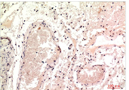Gamma Tubulin Mouse Monoclonal Antibody(7C1)
